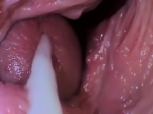 Inside Of Penis 96