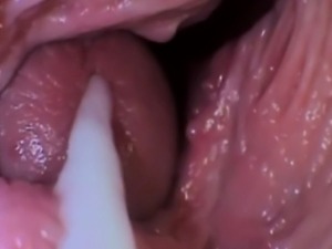 Inside A Penis 13